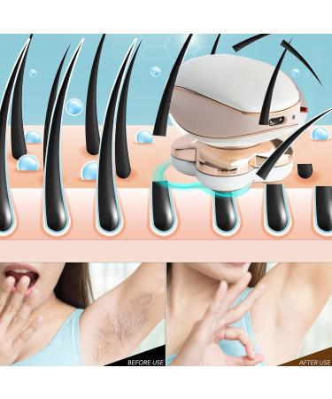 Ruiqas Waterproof Electric Lady Razor Rechargeable and Cordless Painless Women Bikini Remover for Legs Face Body Lips Pink - Buy Online on GoSupps.com