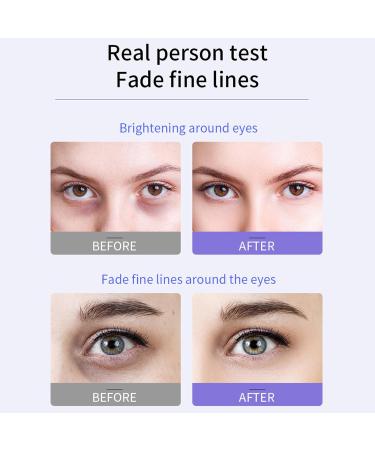Revitalize Your Eyes: Anti-Wrinkle & Dark Circle Eye Cream | Daily Care for Men & Women - 20ml - Buy Online on GoSupps.com