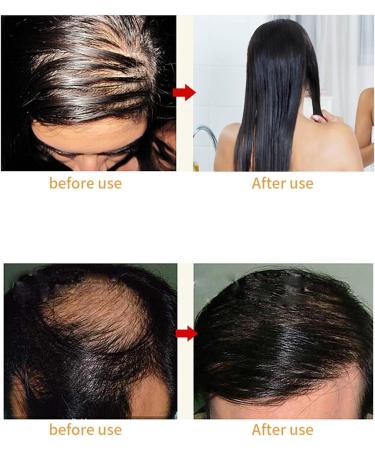 Anti Hair Loss Comb Laser Hair Growth Comb Anti Hair Loss Massager Stimulating Hair Follicle Regulating Oil Secretion Promoting Scalp Health - Buy Online on GoSupps.com