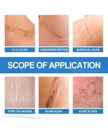 Gomice Scar | Scar Repair Gel for Stretch Marks | Scar Treatment for Surgical Scars Caesarean Sections Cuts & Burns Reduce - Buy Online on GoSupps.com