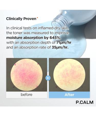 P.CALM Hyaluron Doubleshot Toner 200ml | Vegan Deep Hydrating Facial Toner with Hyaluronic Acid & Centella Asiatica | Korean Skincare for Sensitive Skin - International Shipping Available - Buy Online on GoSupps.com