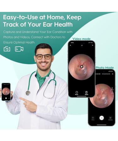 Oxbird 1080P Wireless Ear Wax Removal Kit with Camera - Smart Ear Cleaner for iPhone, iPad & Android - Black - Buy Online on GoSupps.com