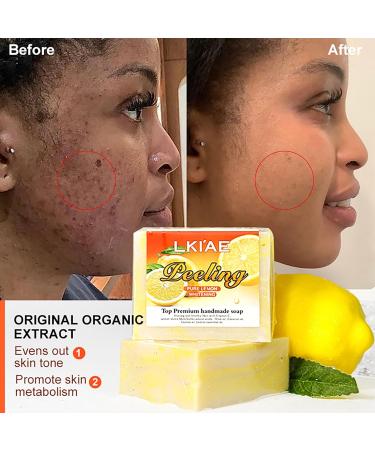  AILKE BOOST LUSTER LKIAE Pure Natural Lemon Whitening Soap Bar Face & Body Cleanser Oil Control Reduce Ance Pimples Blackheads With Shea Butter Vitamin C Kojic Acid 150g (Pack of 1) - Buy Online on GoSupps.com