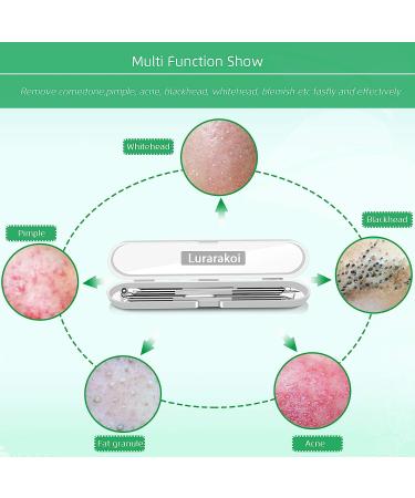 5PCS Blackhead Remover Kit - Professional Stainless Steel Acne Extraction Tools - Buy Online on GoSupps.com