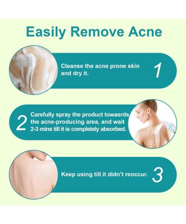 Skin Mist Soothes Irritation 120ml Liquid Against Blemishes Body Acne Spray Improves Skin Clarity For Women Men Youth Shoulder Arm Leg Ma - Buy Online on GoSupps.com