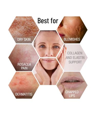Angelyss Skin Firming Anti-aging Serum - Revitalize & Tighten Skin Shop Worldwide - Buy Online on GoSupps.com