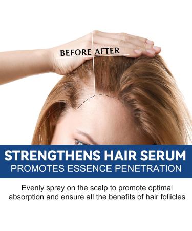 Hair Growth Serum Spray Thinned Hair Liquid Grow Hair Natural Hair Density Essential Oil Hair Growth Oil for Hair Rapid Growth and Thickening Trengthen Hair Roots Gifts for Men and Women - Buy Online on GoSupps.com