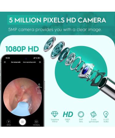 Oxbird 1080P Wireless Ear Wax Removal Kit with Camera - Smart Ear Cleaner for iPhone, iPad & Android - Black - Buy Online on GoSupps.com