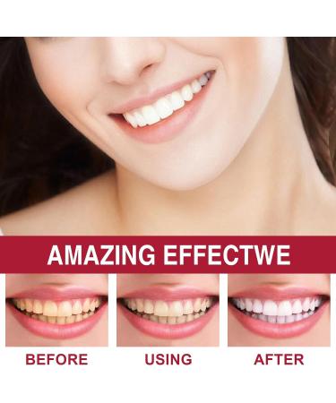 SP-6 Ultra Whitening Toothpaste - Brightening Probiotics Fresh Breath & Deep Cleaning - 4.23 Fl Oz (Pack of 1) | Jasmin Mint - Buy Online on GoSupps.com