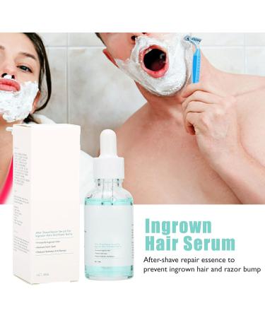 Ingrown Hair Serum Smooth Bump Solution for Women for Home for Men - Buy Online on GoSupps.com