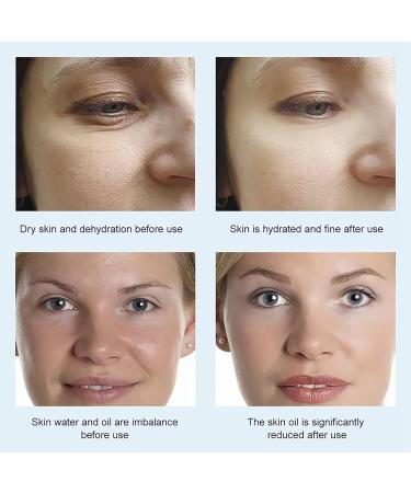 Hyaluronic Acid & B5 Toner for Face - Hyaluronic Acid Face Toner - B5 Face Toner Essence Water - Moisture Hydrate Refresh Plump Skin - Smooth Tender Firm Lift Pore - Restore Elasticity Reduce Dryness - Buy Online on GoSupps.com