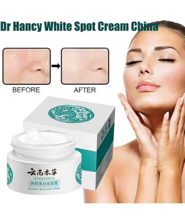 Peehss Dr HANCY Yunnan Herbal Whitening Cream - Fades Spots, Brightens Skin Tone, Japanese Melasma Cream (2PCS) - Buy Online on GoSupps.com