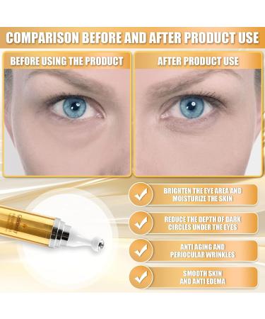 Best Caffeine Eye Cream for Dark Circles & Wrinkles | Anti-Aging Eye Care for Men & Women - Buy Online on GoSupps.com