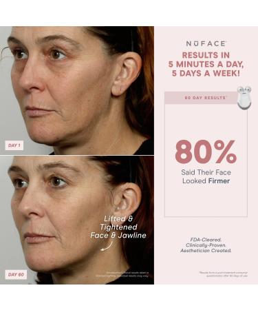 NuFACE Mini & FIX Starter Kits - FDA Cleared Microcurrent Device for Face Sculpting & Line Smoothing - Aqua Gel & FIX Serum Included - Buy Online on GoSupps.com