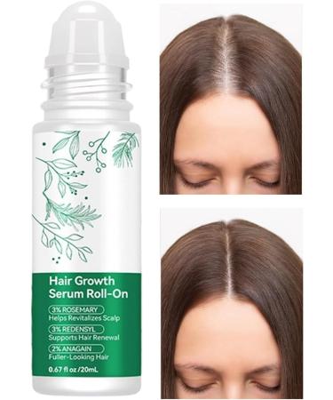 Hair Growth Serums RollOn Reduces Split Ends 20 ml Nourishing Oil The Scalp Oil Reducing Hair Loss Soft and Soothing Reduced Loss Thickness Volume H - Buy Online on GoSupps.com