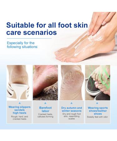  Beslibate Urea cream urea foot cream 40% urea lotion for maximum strength feet foot and hand cream with hyaluronic acid urea foot lotion 50 g *2 cream4-5 - Buy Online on GoSupps.com