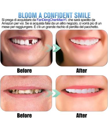 2 Sets of Comfort Fit Fake Braces & Instant Perfect Smile Veneers - Flexible Artificial Teeth for a Beautiful Smile - Buy Online on GoSupps.com