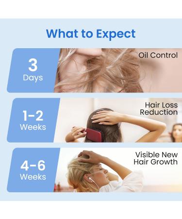 KX-826 DHT Blocker Hair Growth Spray | 1-Month Supply for Men & Women | Thicken Hair Reduce Hair Loss Visible Results in 4-6 Weeks | International Shipping Available - Buy Online on GoSupps.com