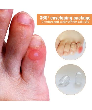 Silicone Gel Toe Protectors - Anti-Friction & Breathable Toe Covers for Men and Women (10Pcs) - Buy Online on GoSupps.com
