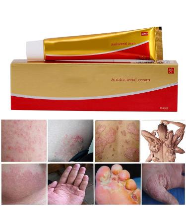 Chinese Medicine Natural Eczema & Psoriasis Cream for Dermatitis, Inflammation & Rashes - Buy Online on GoSupps.com