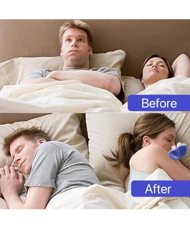 Electric Anti Snoring Device with Fixing Strap | Adjustable Nasal Dilator | Stop Snoring Solution | Nose Vents for Men Women (Blue) - Buy Online on GoSupps.com