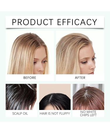 Volumizing Hair Spray for Fluffy Oil-Control Fluffy Volume Lift Hairspray Leave-in Dry Hair Spray Fluffy Oil-Control Lift and Long-Lasting Volume for All Hair Types - Buy Online on GoSupps.com