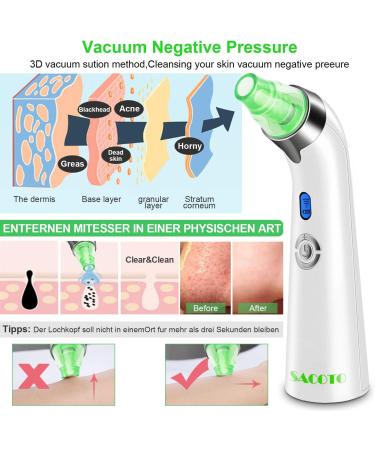 Pore Vacuum Blackhead Remover Cleanser | 5 Power Electric Extractor Tool for Women & Men | 4 Probes | Green - Buy Online on GoSupps.com