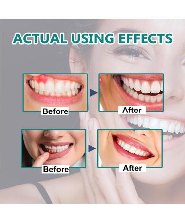  GNAUMORE Dentizen Drops Gum Regeneration Gel Regenerating Gum Gel Gum Regrowth Drops Gum Growth Drops Gum Regrowth Repair - Buy Online on GoSupps.com