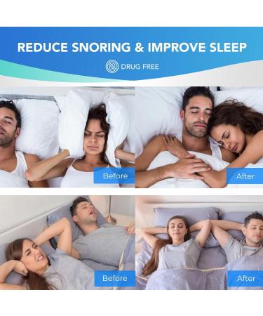 Anti Snoring Devices: Snoring Solution - Snoring Mouth Guard - Stop Snoring Devices - Anti Snoring Mouthpiece - Mouth Guard for Snoring - Night Guard for Grinding Teeth - Snore Guard Clear - Buy Online on GoSupps.com