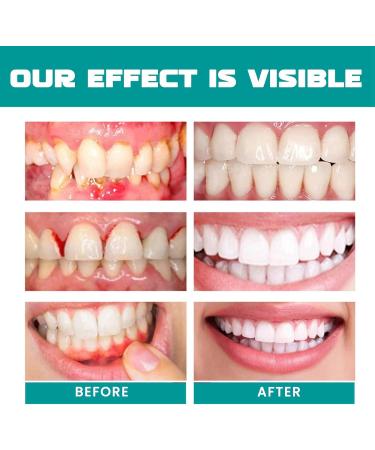 Gum Repair Spray Oral Care Spray Gum Health Spray Toothache Pain Relief Relief Sore Gums Gum Regrowth Spray Toothache Relieving Spray Helps Protect and Recovery of Damages Gums and Oral Cavity - Buy Online on GoSupps.com