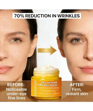 All In One Collagen Bee Venom Cream 2026 Natural Bee Venom Skin Treatment Cream - Infused with Organic Bee Venom Serum Hyaluronic Acid and Peptides | Intense Lifting Hydration & Wrinkle Care 1 - Buy Online on GoSupps.com