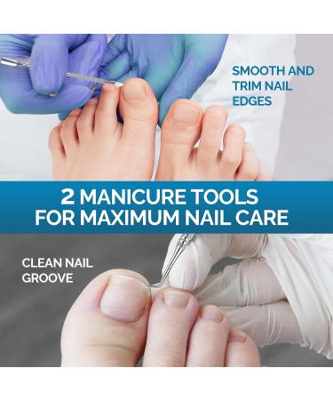 Ingrown Toenail Treatment - Painless Corrector Patch Strips with Nail Correction Tools | 50 Patches, Blue - Buy Online on GoSupps.com