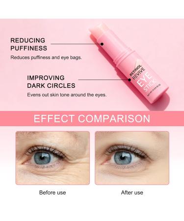 Retinol & Caffeine Eye Balm Stick - Dark Circles Relief & Depuffing Treatment Hyaluronic Acid + Collagen Gentle Under Eye Cream for Sensitive Skin Hydrates & Smooths Fine Lines - Buy Online on GoSupps.com