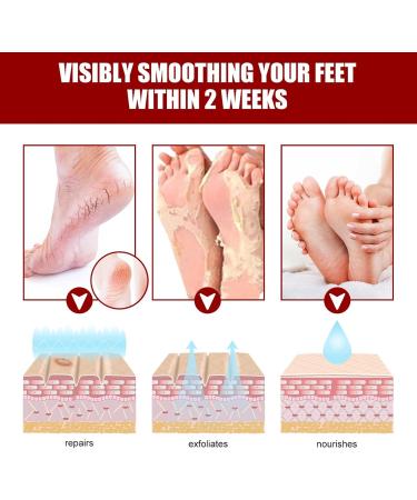 Adawd Foot Peeling Mask - Moisturizing Treatment Socks for Baby Soft Feet Removes Dead Skin & Repairs Cracked Heels - 1 Piece - Buy Online on GoSupps.com