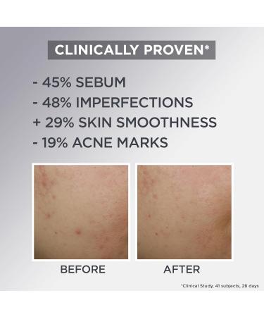 Garnier Pure Active AHA+BHA Charcoal Daily Mattifying Air Cream - Buy Online on GoSupps.com