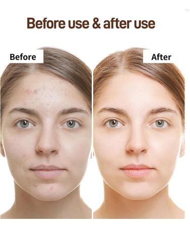 Glutathione Face Cream - Even Skin Tone Face Cream - Kojic Acid Face Cream - Sensitive Moisturising Cream - Face Moisturiser Cream - Anti Wrinkle Anti Aging Skin Tone Correcting (50g) - Buy Online on GoSupps.com