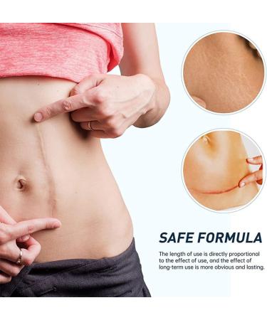 Silicone Scar Remover Gel - Effective for Old & New Scars - 1.06 oz - 3PCS Set - Buy Online on GoSupps.com