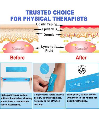 ATETEO Kinesiology Tape M - Dark Blue, Large Size 5m x 5cm - Buy Online on GoSupps.com