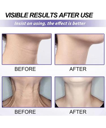Neck Firming Cream Neck Tightening Cream Tighten and Lift Neck Cream Anti-Aging Neck Cream for Tightening and Wrinkles Advanced Tightening Moisturizer for Firm Retinol Moisturizer Cream for Women - Buy Online on GoSupps.com