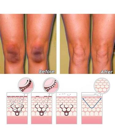 EXQST Dark Spot Correcting Cream Skin Brightening Cream for Intimate Areas Whitening Moisturizing Cream for Underarm Legs for Knees - Buy Online on GoSupps.com