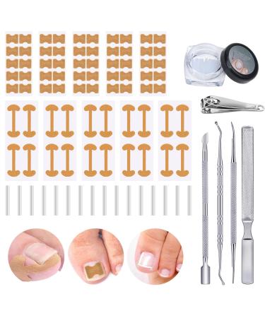 105 pieces of ingrown toenails tool set pedicure set with an ingrown correction sticker nail tongs nail slide nail files nail folding tamponade tube - Buy Online on GoSupps.com