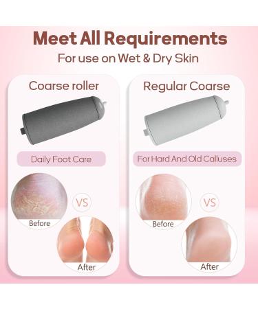 Smooth Pedicure Wand - Electric Foot Callus Remover | Rechargeable Pedicure Tool for Feet Care | Removes Dry Skin & Dead Skin - Ideal Gift (Pink - Buy Online on GoSupps.com