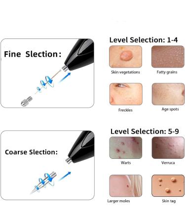 CHRERNA Skin Tags & Mole Removal Kit - 9 Modes Plasma Pen for Warts, Spots, Body & Facial Nevus - Buy Online on GoSupps.com