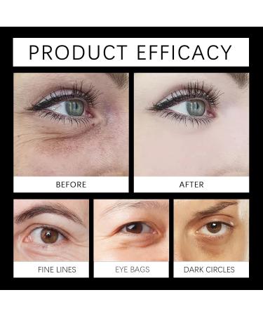 True Bright Eye Cream Eye Contour Cream Eye Bright Cream helps dark circles and tired eyes Brightening Dark Circle Eye Cream Korean Skincare - Anti-aging & anti dark circles 15 ML (3pc) - Buy Online on GoSupps.com