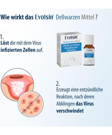 Evolsin Molluscum Warts Agent I For Adults & Children from 2 Years Gentle & Effective Molluscum Warts Treatment - 0.16 Oz - Buy Online on GoSupps.com