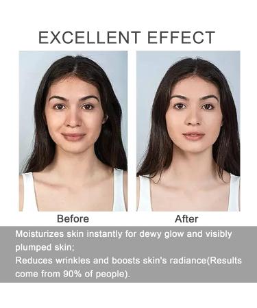 Niacinamide Serum 10% + Zinc PCA 2% - Anti-Aging Dark Spot & Wrinkle Reduction with Hyaluronic Acid & Organic Aloe Vera | 1 Fl Oz - Buy Online on GoSupps.com