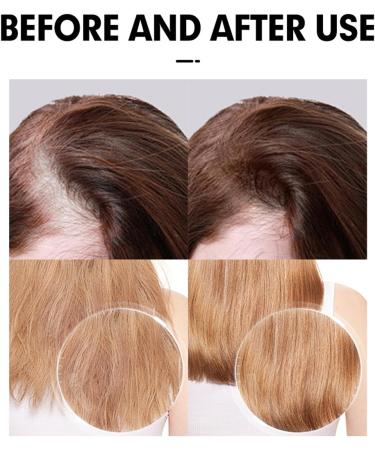 WJnflQN Hair shampoo Shampoo For WomenRefreshing Cleansing Moisture Volume Stimulation 200ml Clarifying Conditioner For Scalp Care Travel - Buy Online on GoSupps.com