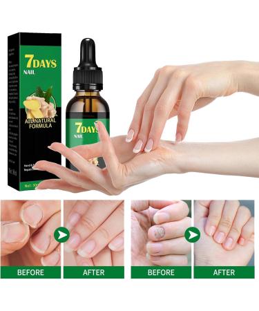 FLLUOUZH 3 Pieces 7 Days Ginger Nail Ginger Nail Treatment Nail Support Nail Care Ginger Nail Growth Serum Ginger Cuticle Care Oil for Nails - Buy Online on GoSupps.com