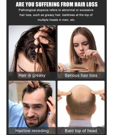 ZXCVB Infrared & Red Light Therapy Cap Hair Regrowth Helmet for Thinning Follicle Healing Hair Care Headwear for Hair Growth - Buy Online on GoSupps.com