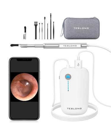 Teslong Digital Otoscope with Ear Wax Remover, Teslong Ear Camera with Ear Wax Removal Tools, Video Ear Scope Otoscope with Light for iPhone, iPad, Android Phone, USB, Ear Picks, Waterproof, 1080p HD